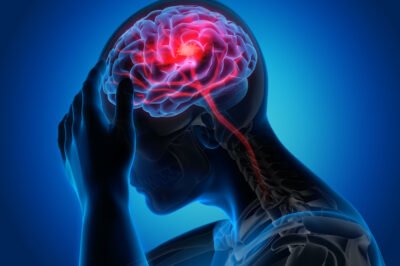 Preventing Ischemic Strokes: Doctors Emphasize the Importance of Managing Risk Factors